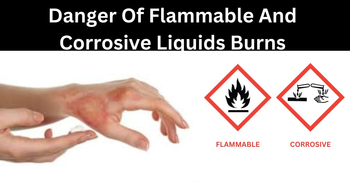 Danger Of Flammable And Corrosive Liquids Burns